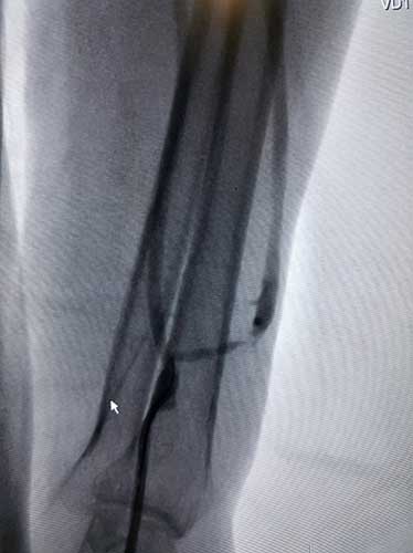 Chubby eshak it uslubi